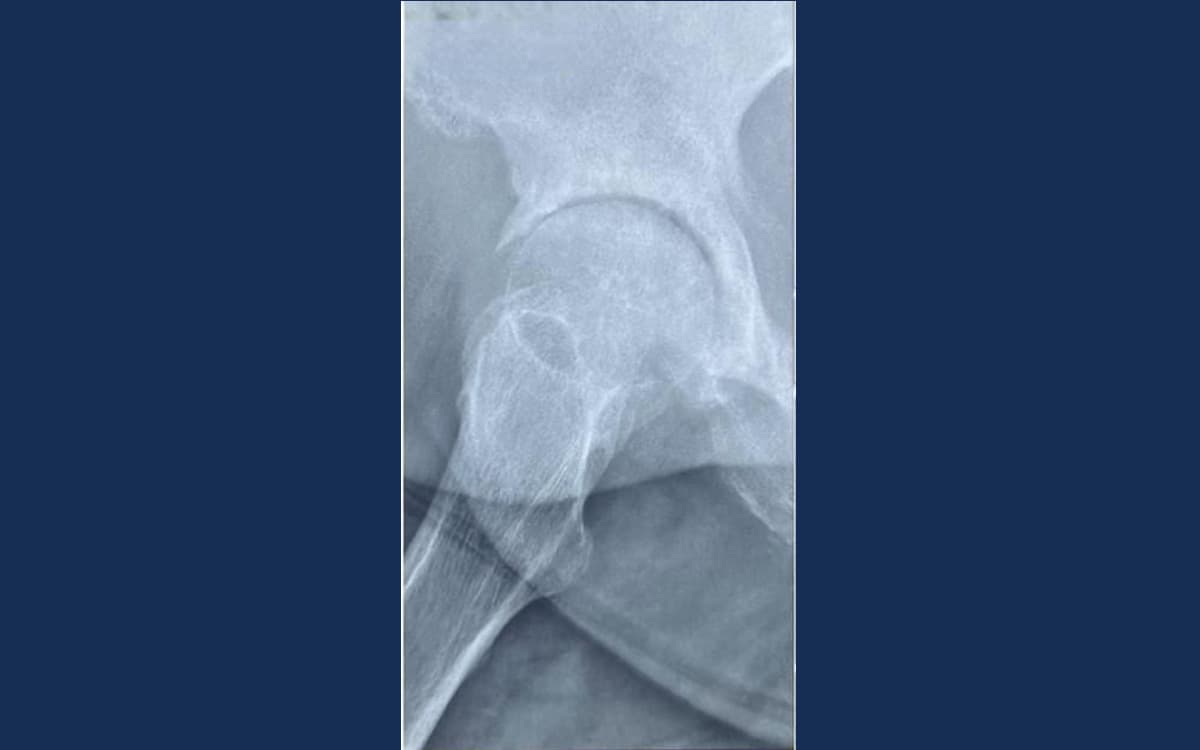 After treatment