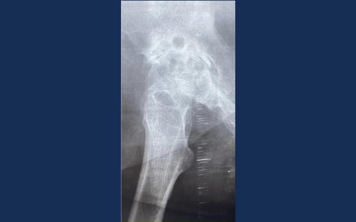 Before treatment