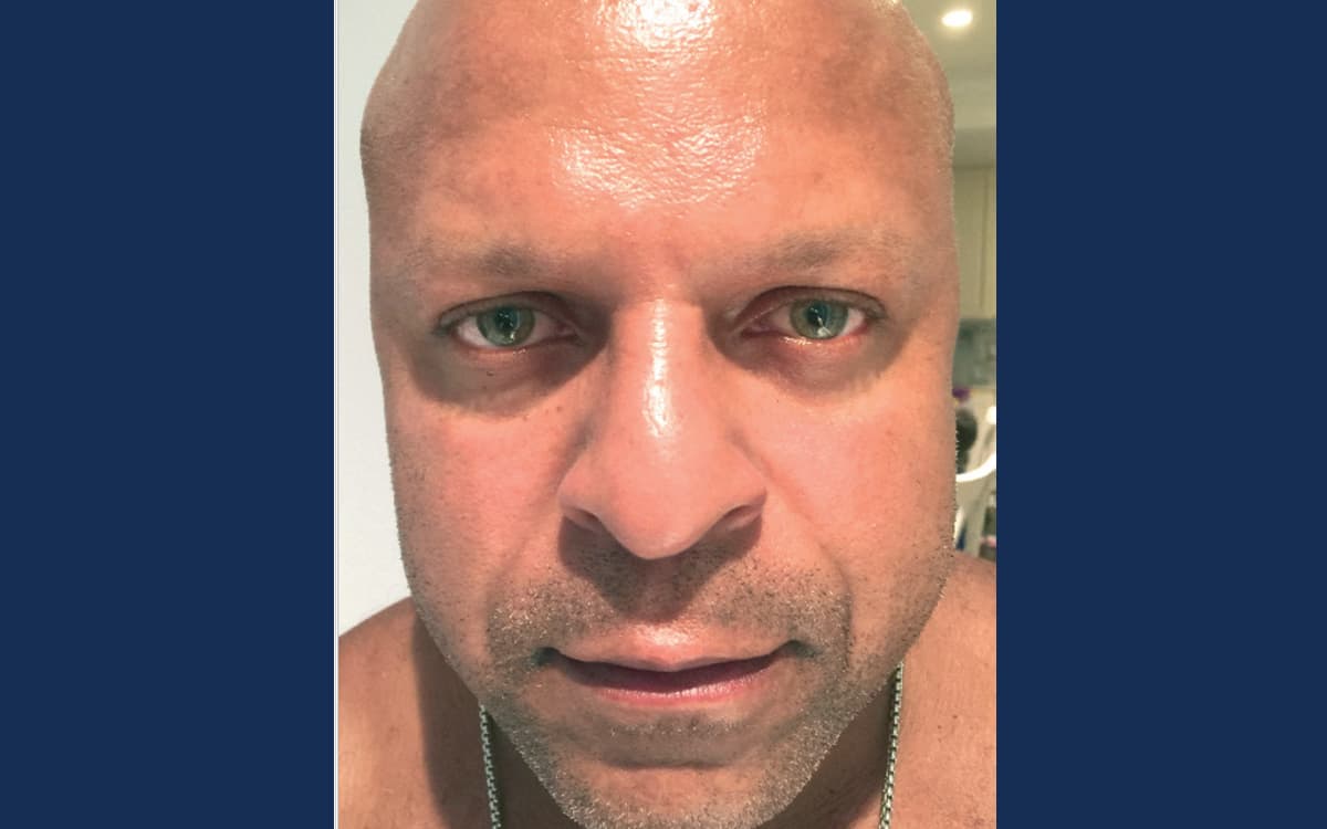 After treatment