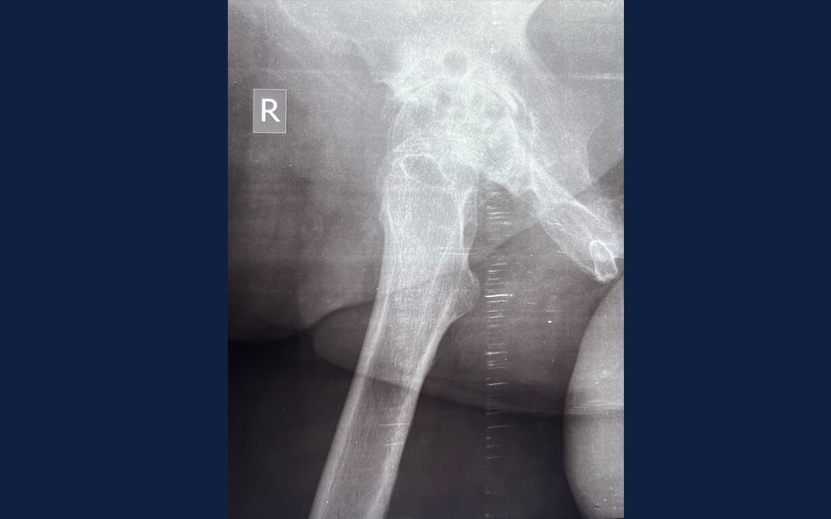 Before treatment