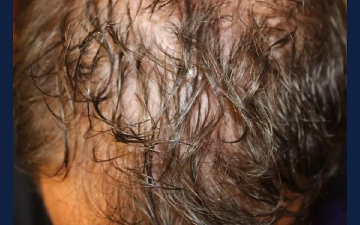Before treatment