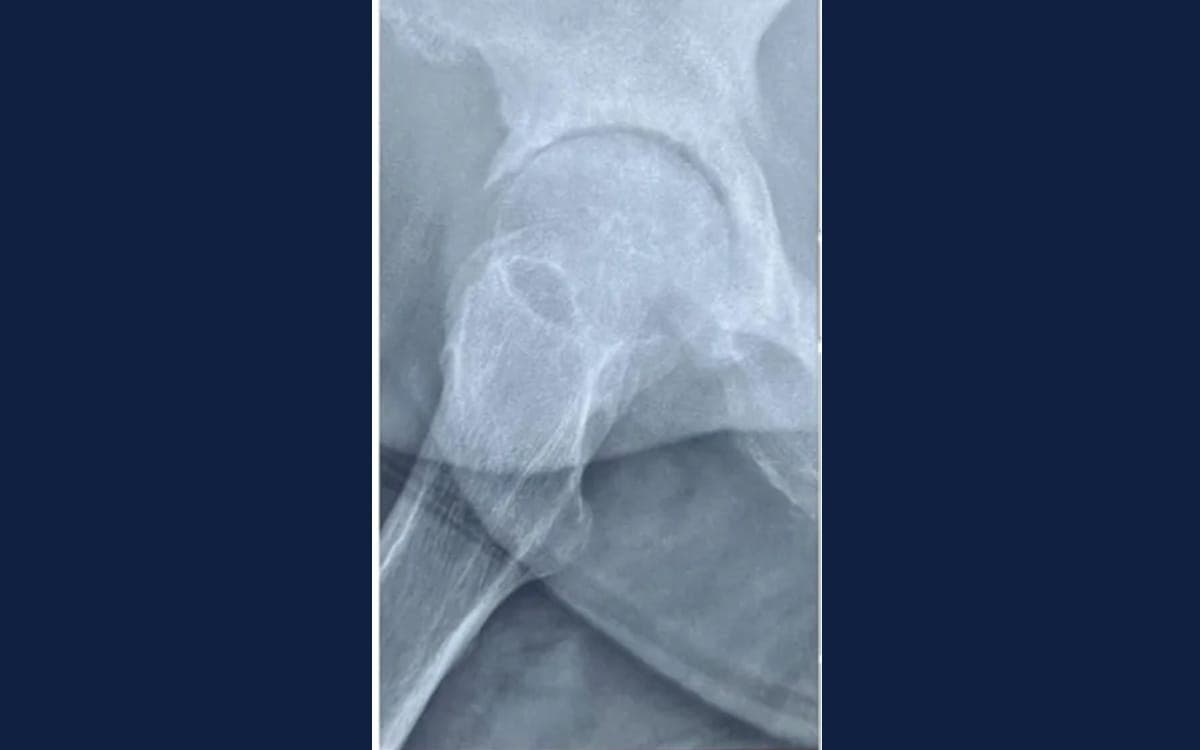 After treatment