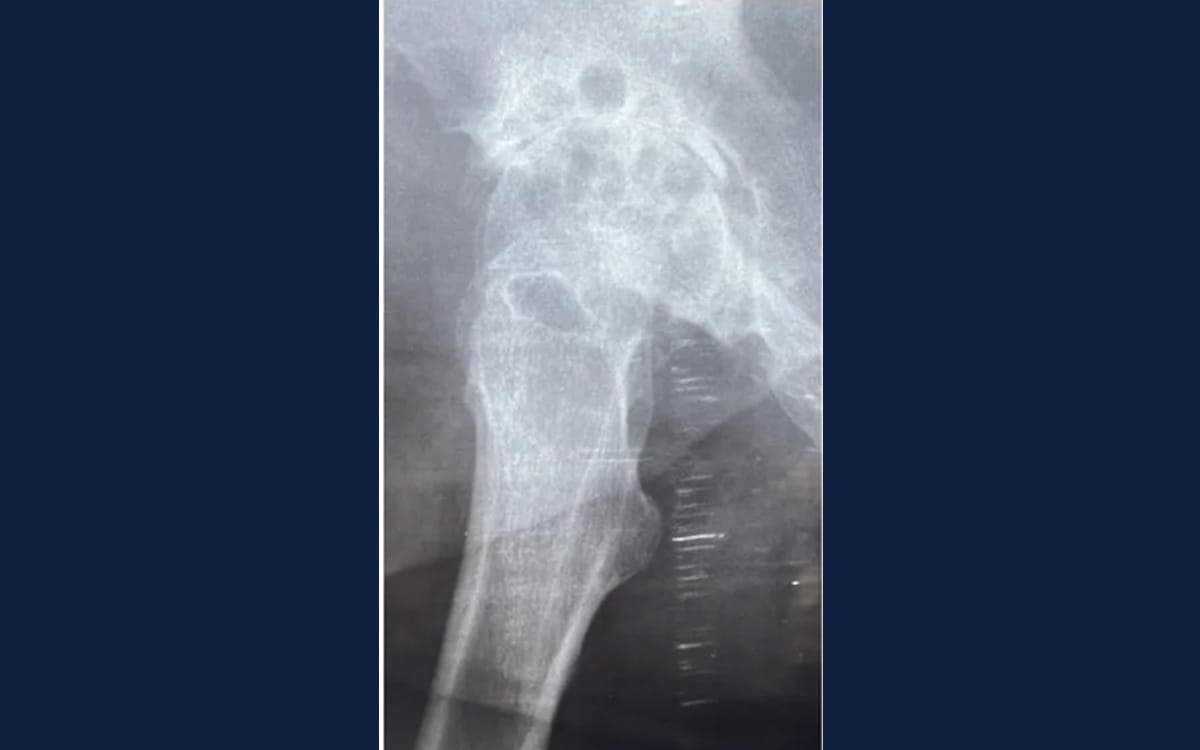 Before treatment