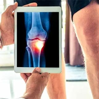Prolotherapy